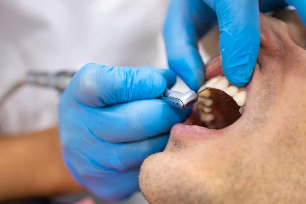 Emergency tooth extraction Suwanee GA