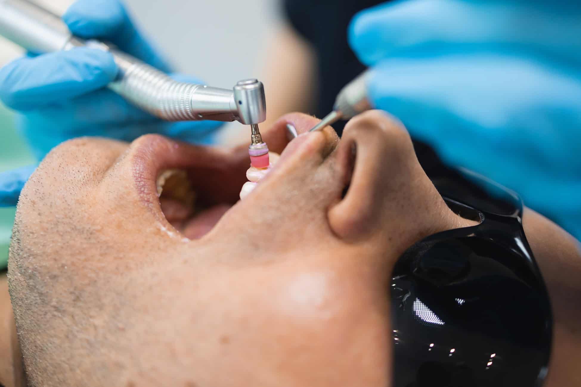 preventive dental services Suwanee GA