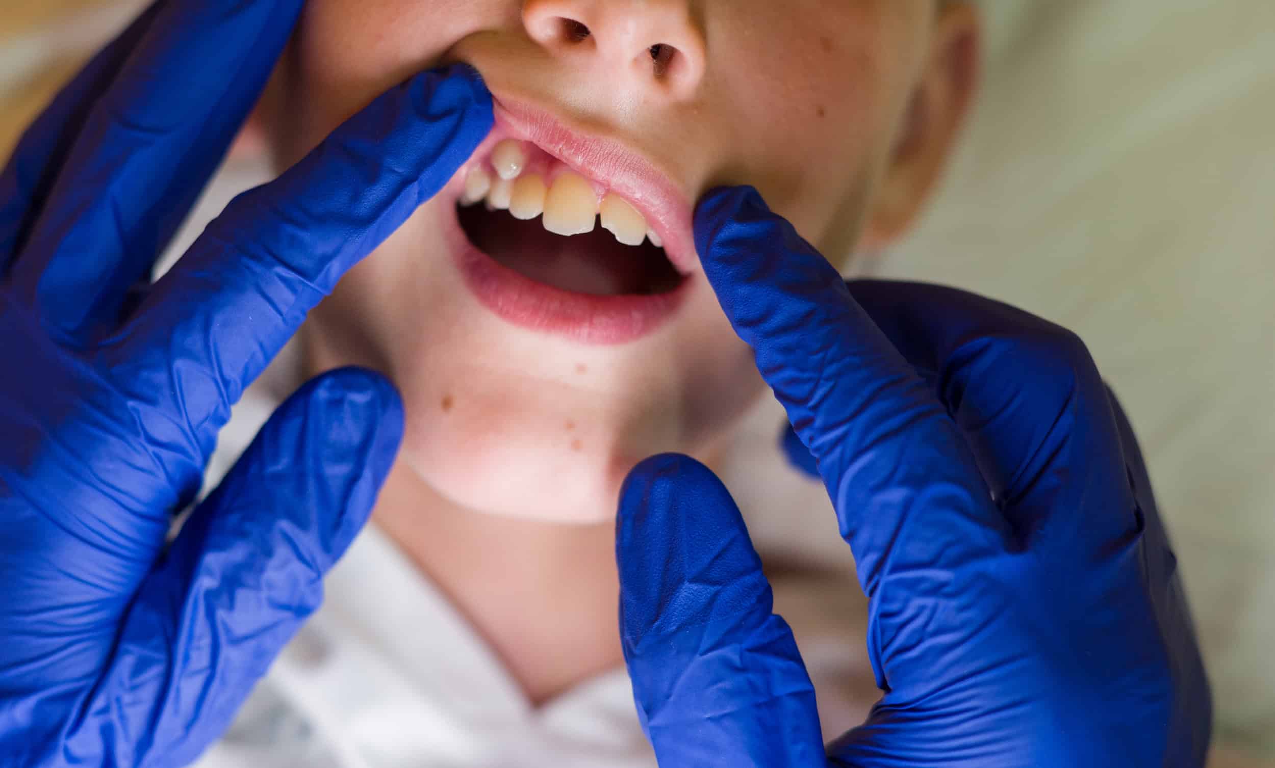 pediatric dental infections Suwanee GA