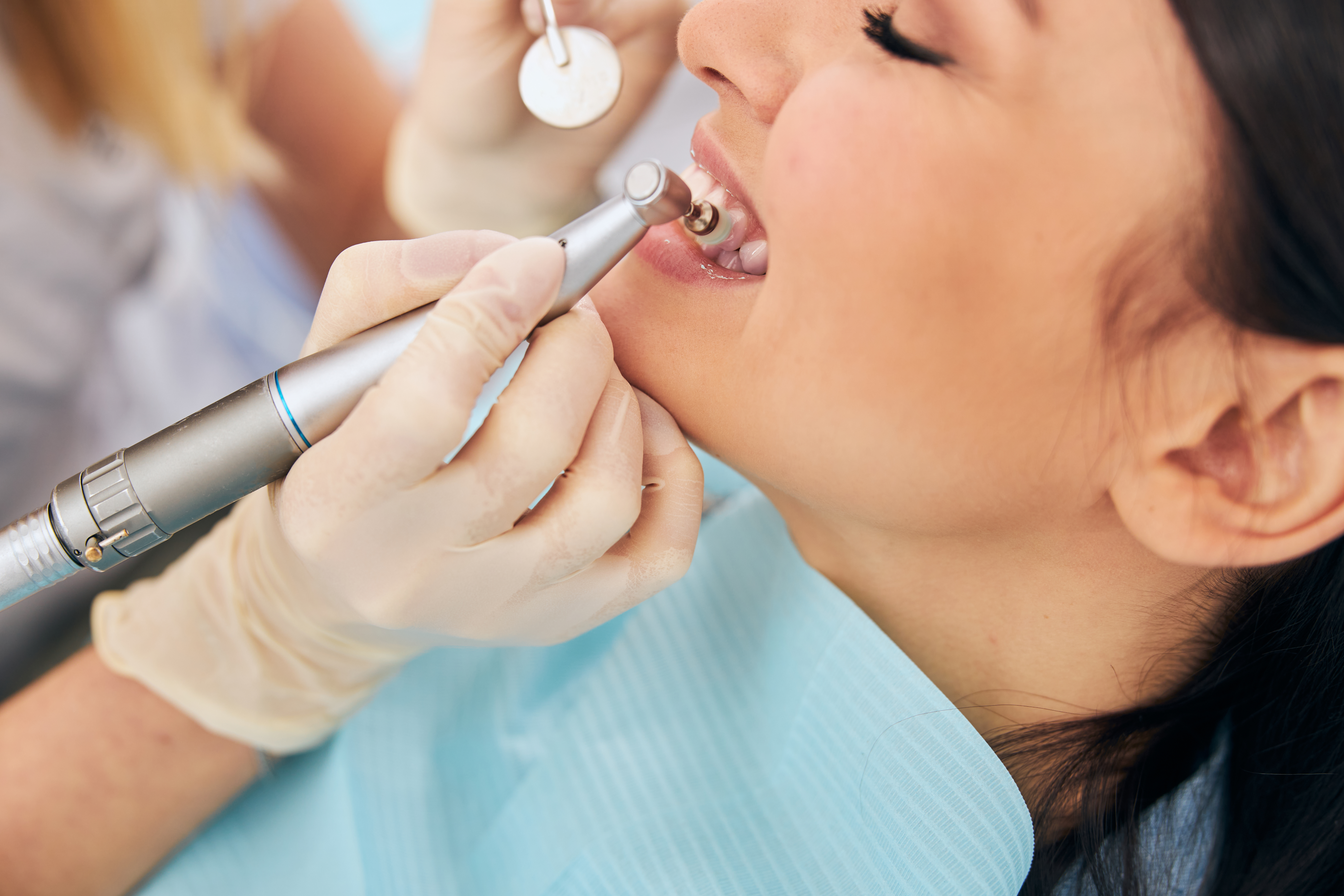 teeth cleaning Suwanee GA