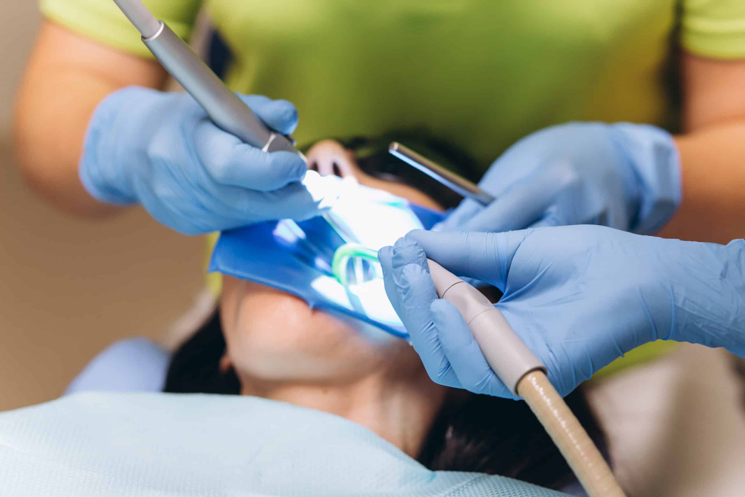 Dental Cleaning in Suwanee GA
