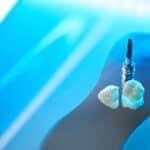 tooth extraction Suwanee GA